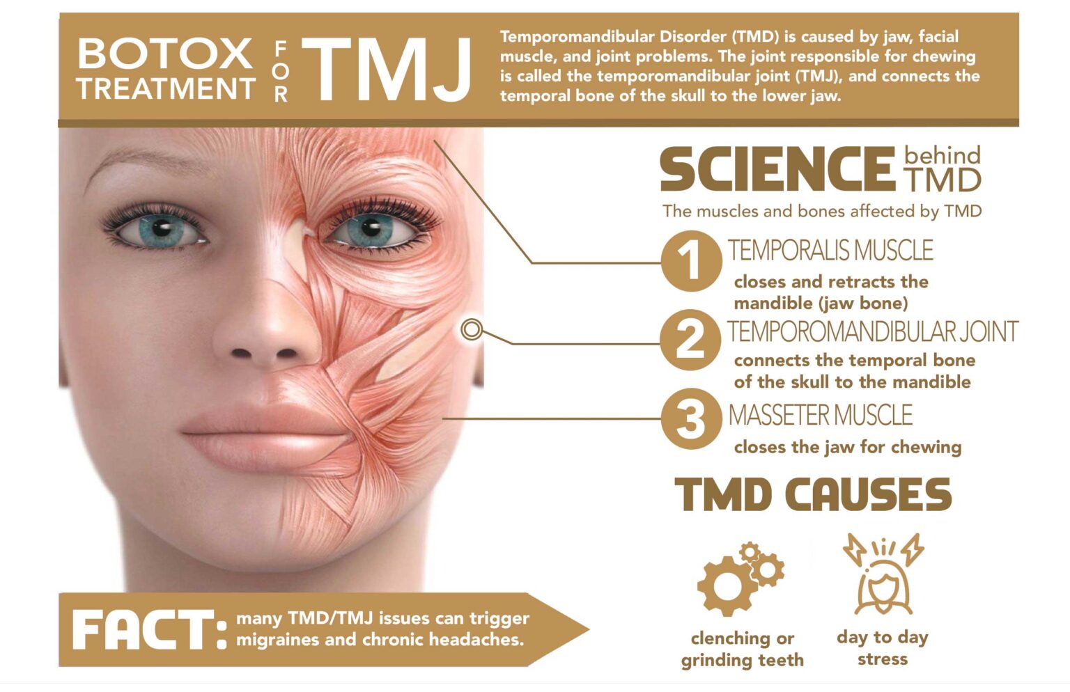 Botox For TMJ And Migraines Highly Effective BEAUX MEDSPA