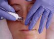 Patient receiving a diamond glow facial at Beaux MedSpa, Benefits of a facial