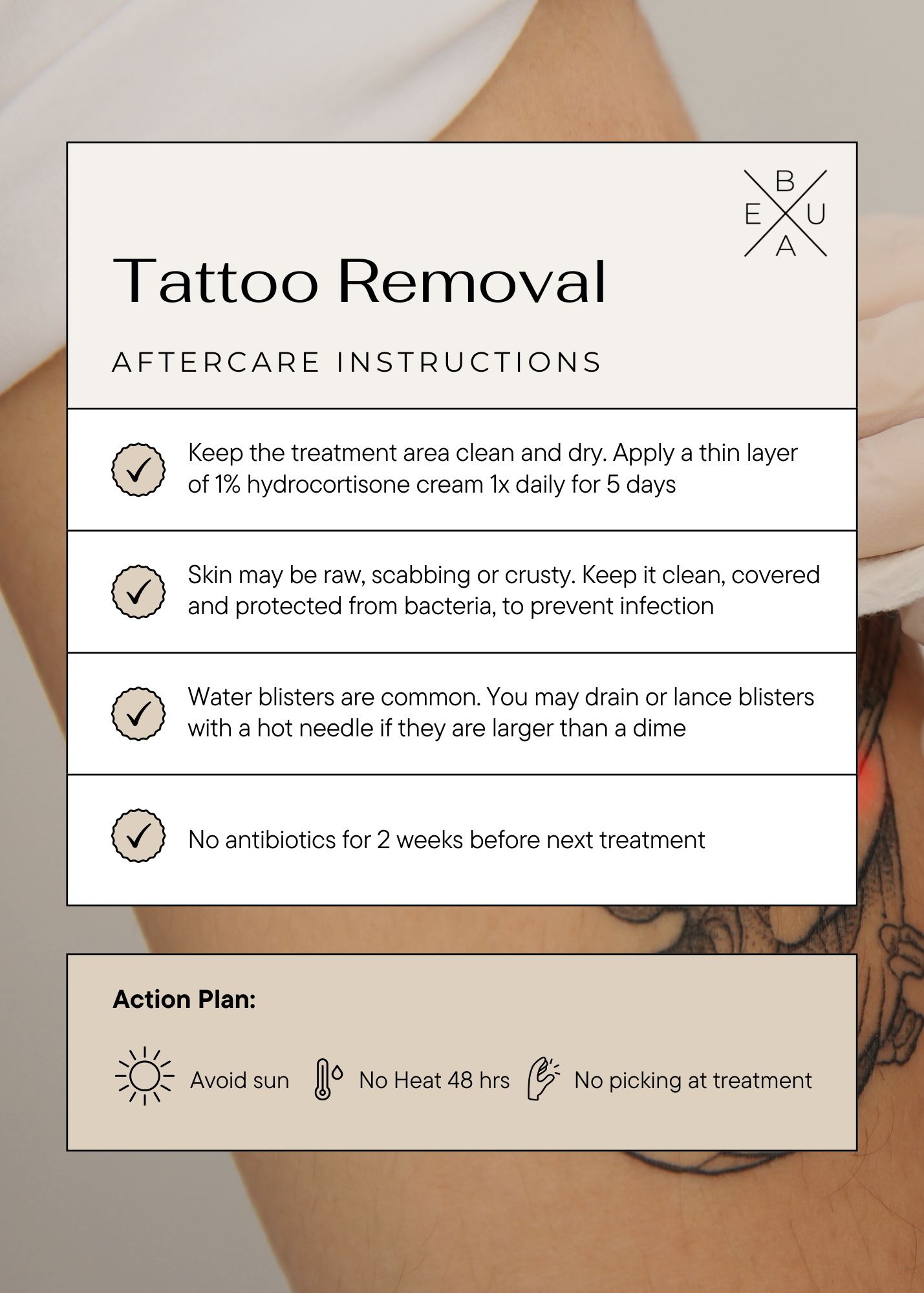 Tattoo Removal Austin aftercare instructions