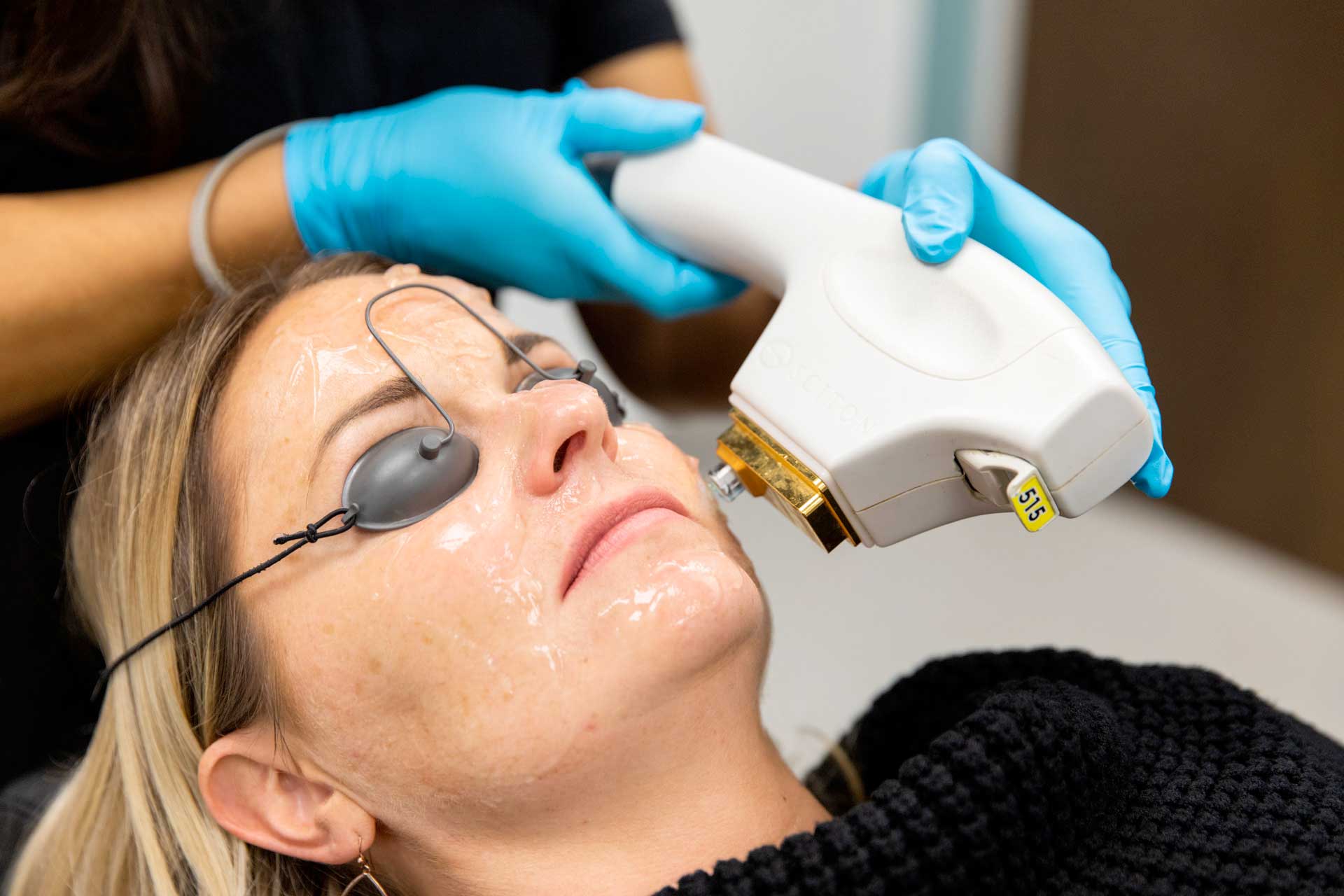 Laser hair removal treatment at BEAUX MedSpa in Austin