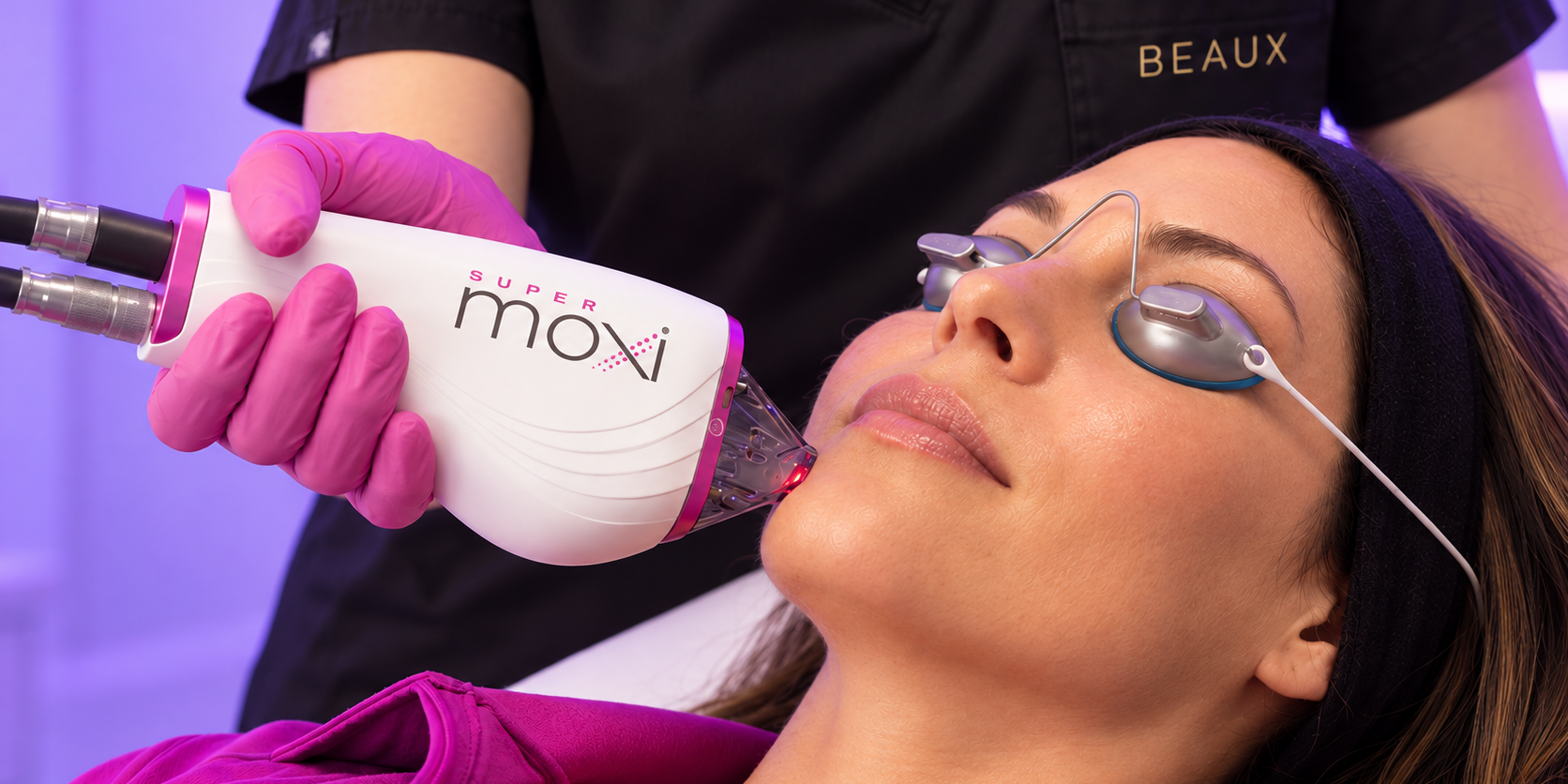 super moxi laser treatment in austin Super MOXI laser Austin